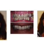 galería de sonrisas - josephine