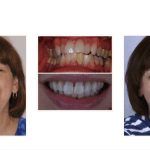 galería de sonrisas - diane