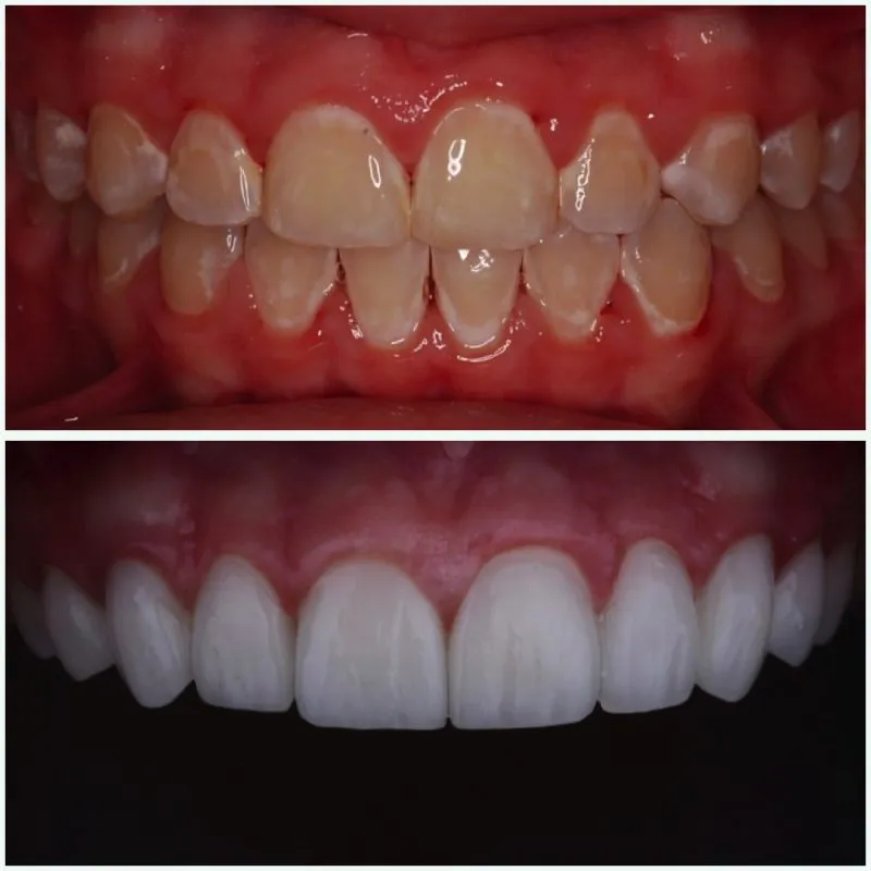 galería de sonrisas