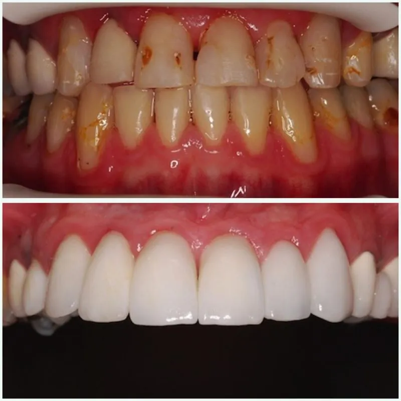 Sonny Square intraoral