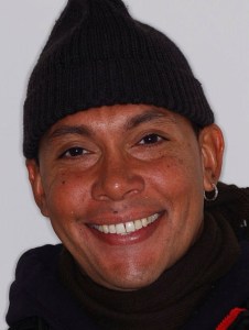 Marcus before Invisalign, whitening & bonding