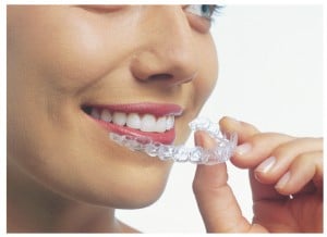 invisalign adulto