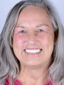 Pacient smiling