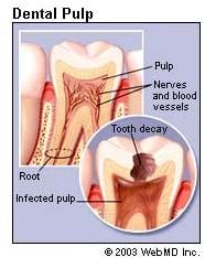 dental-pulp