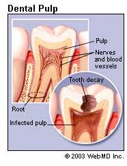 dental-pulp