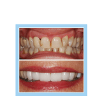 galería de sonrisas - beverly