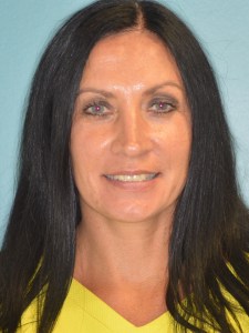 Woman Before full mouth rehabilitation