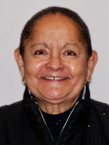 woman before Upper Veneers and lower Invisalign