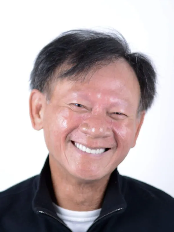hombre después de implantes dentales
